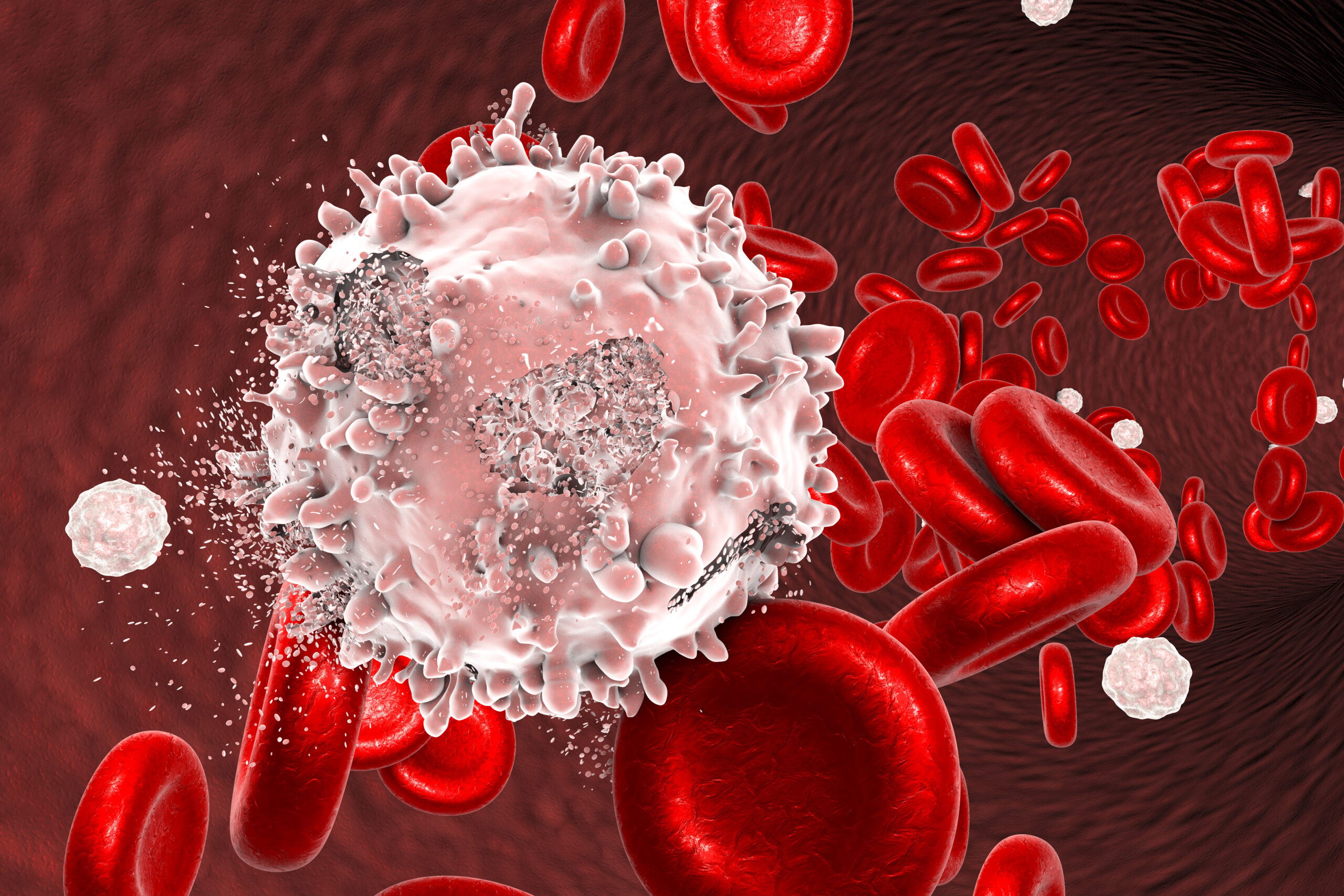Destrucción de célula leucémica, imagen conceptual. Ilustración 3D que puede utilizarse para ilustrar el tratamiento del cáncer de sangre.