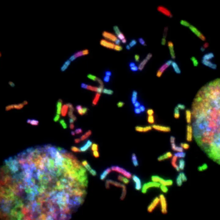 Chromosomes d'un glioblastome malin